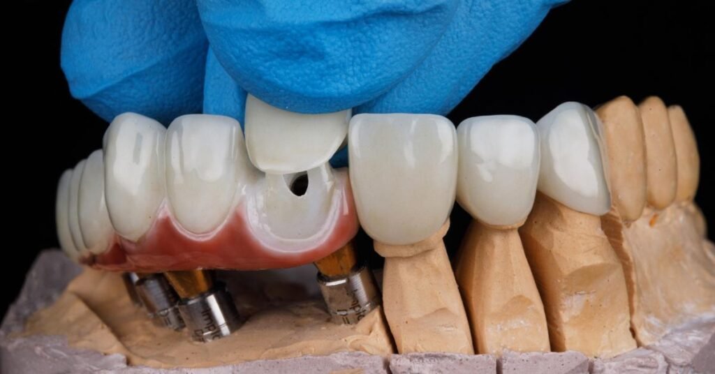 dental crown clinic
