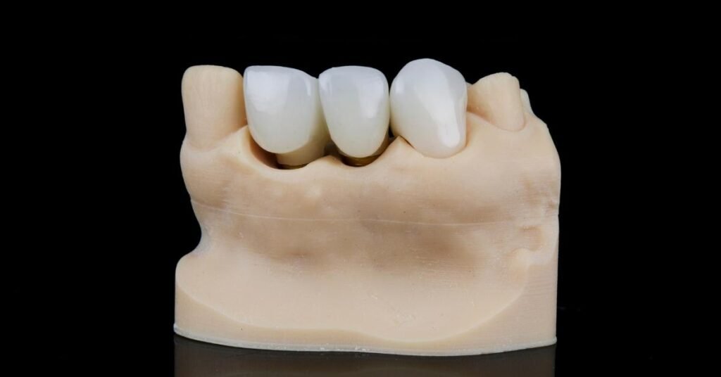 dental crown clinic