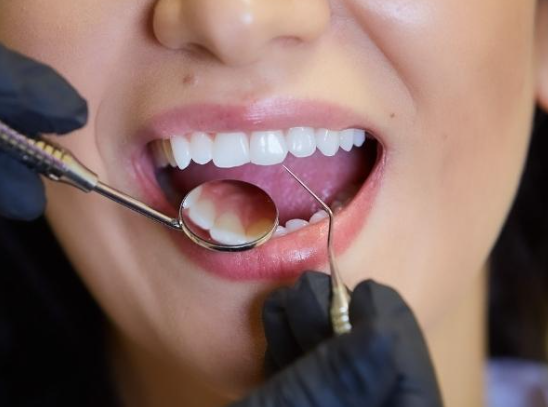 Root canal treatment side effects