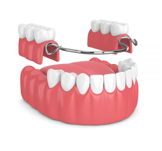 Why do people get dentures?