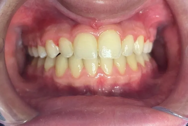 After image