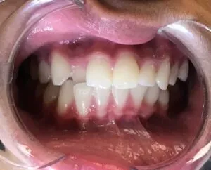 Before image