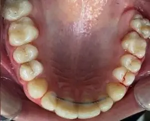 Before image