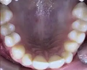 After image