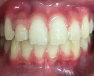 After image