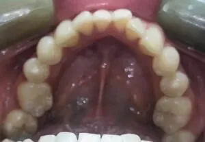 Before image